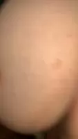 he’s pulling my lips out