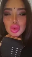 Kisses
