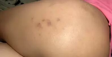 Aftermath of some birthday spankings 🎂