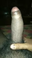 Pulling off the Foreskin