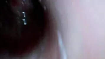 backing out of bladder