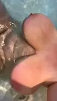 Great veins in the tub.