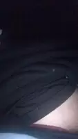 My foreskin