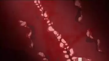 Getting in Deep