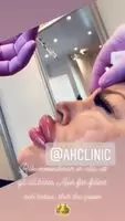 Huge